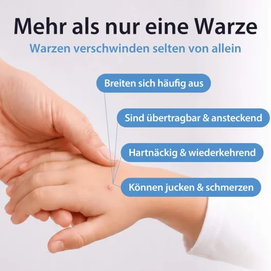 Acetocaustin Lösung Warzenmittel 2 ml