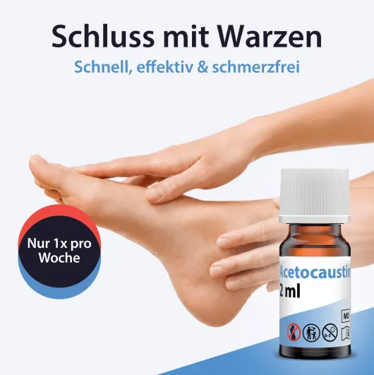 Acetocaustin Lösung Warzenmittel 2 ml