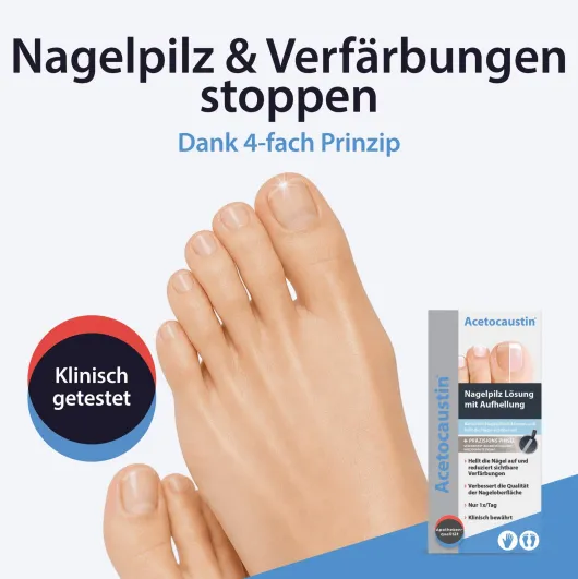 Acetocaustin Nagelpilz Lösung mit Aufhellung 9 ml