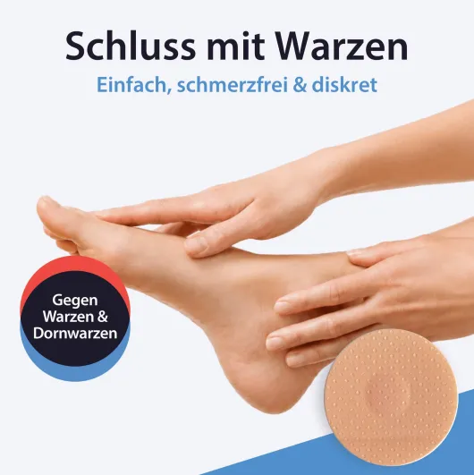 Acetocaustin 20 Warzenpflaster