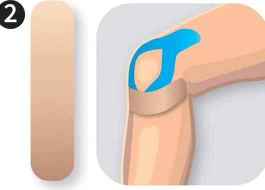 AcuTop Precut Kinesiologie Tape Knie 5 x 20 cm I-Type + Y-Type je 8 Stück