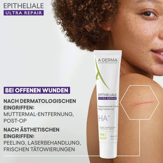 A-Derma Epitheliale Ultra Repair Creme 40 ml