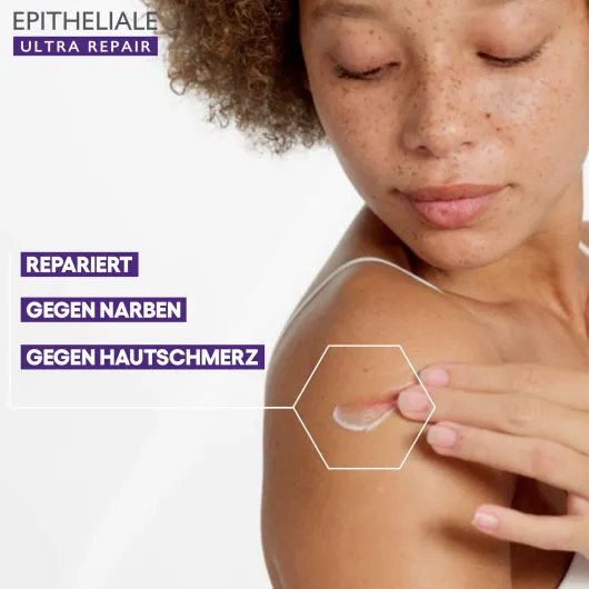 A-Derma Epitheliale Ultra Repair Creme 40 ml