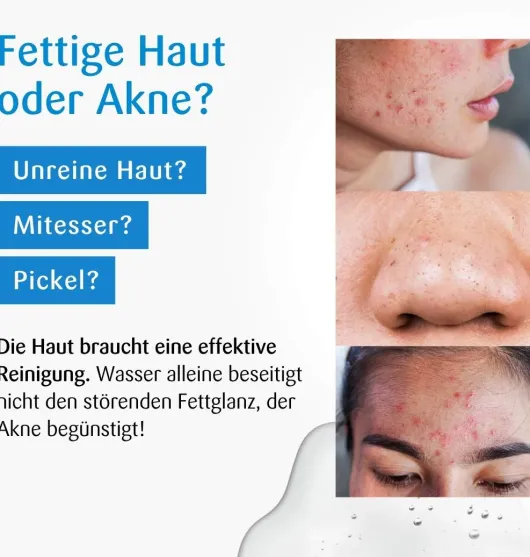 Benevi Hydroderm Gesichts-Reinigung 125 ml