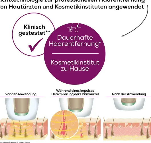 Beurer IPL 5500 Pure Skin Pro Haarentferner