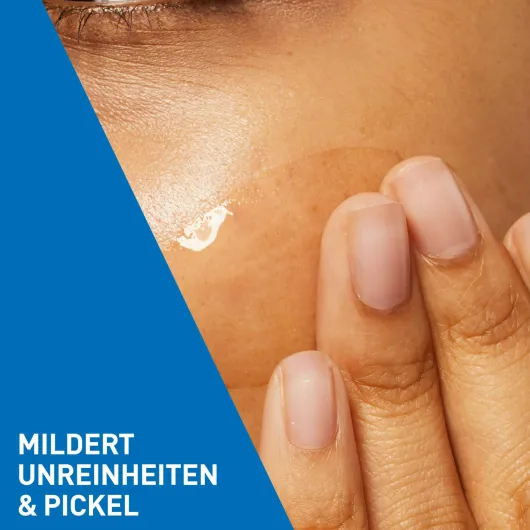 Cerave Anti-Unreinheiten Gel 40 ml
