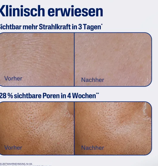 Cetaphil schützendes Tagesserum 30 ml