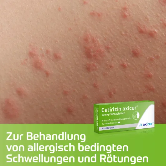 Cetirizin Axicur 10 mg 10 Filmtabletten
