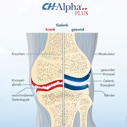 CH Alpha Gelenk 100 ml Gel