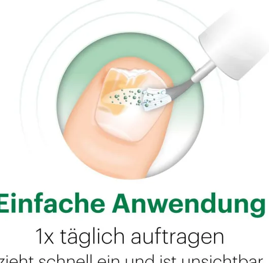 Ciclopoli gegen Nagelpilz 6,6 ml