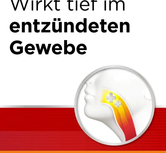 Dobendan Direkt zuckerfrei Flurbiprofen 8,75 mg 24 Lutschtabletten