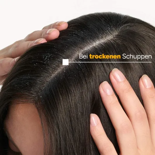 Ducray Kelual Squanorm trockene Schuppen 400 ml Shampoo