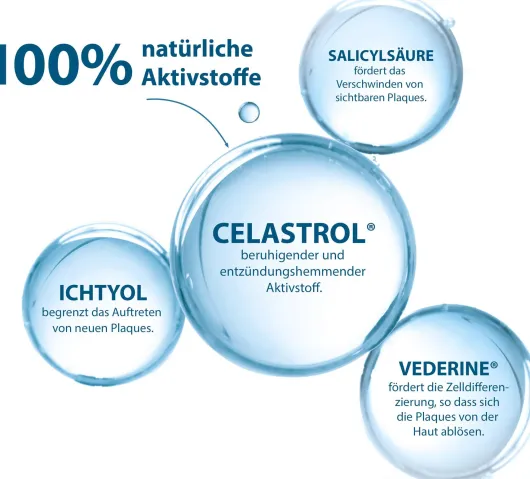 Ducray Kertyol PSO Kur-Shampoo 200 ml