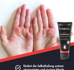 Ensbona Akut Handbalsam 75 ml