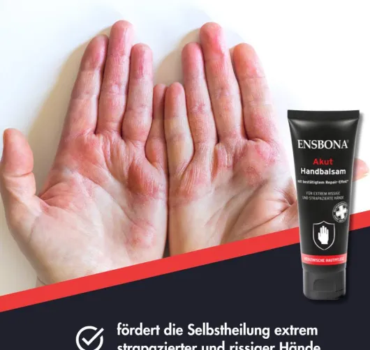 Ensbona Akut Handbalsam 75 ml