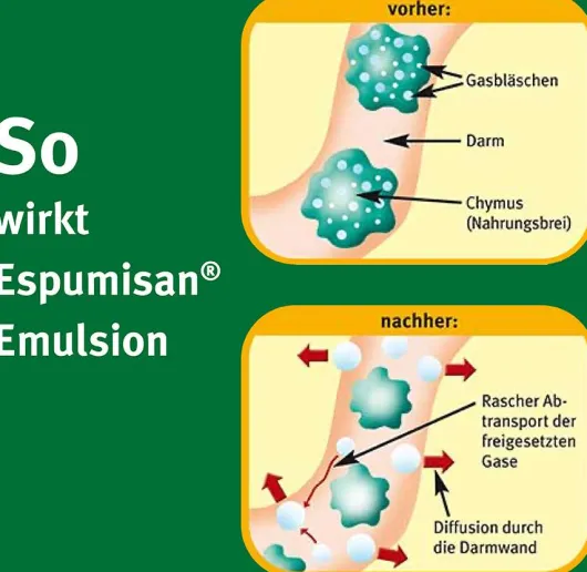 Espumisan Emulsion 3 x 30 ml