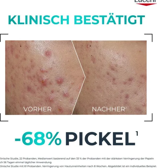 Eucerin DermoPure Clinical Probiom 8 Routine-Set 1 Stück