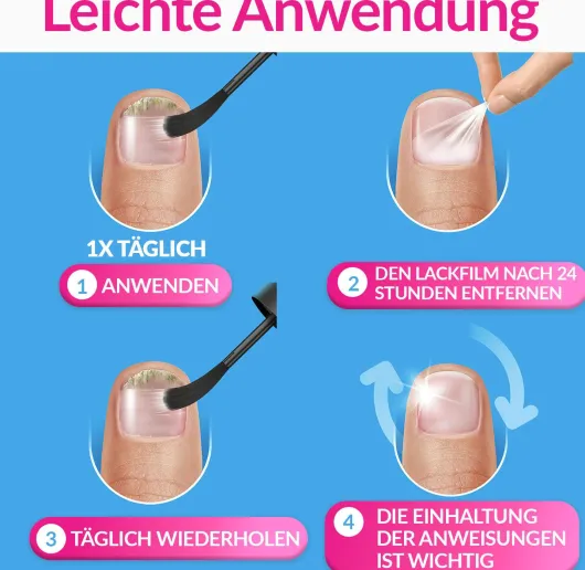 Excilor Intensiv Lack Gegen Nagelpilz 30 ml