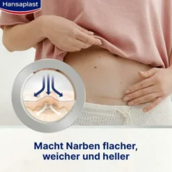 Hansaplast Pflaster Narben Reduktion 3,8 cm X 6,8 cm 21 Stück