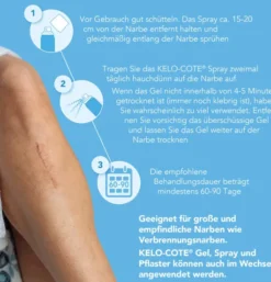 Kelo-Cote Spray Silikonspray zur Behandlung von Narben