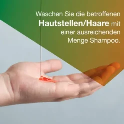 Ketozolin 2% Shampoo 60 ml