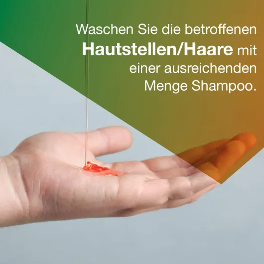 Ketozolin 2% Shampoo 60 ml