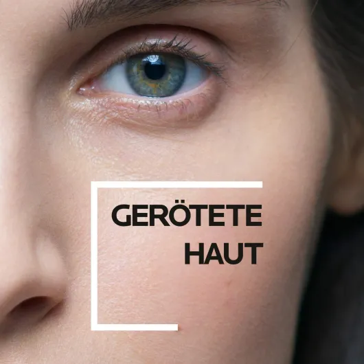 La Roche Posay Toleriane Rosaliac AR LSF 30 50 ml Creme + gratis Roche Posay Toleriane Dermallergo Augencreme 2 ml