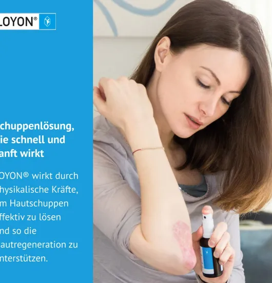 Loyon bei Schuppigen Hauterkrankungen 50ml Lösung