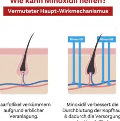 Minoxidil Doppelherz Pharma 50 mg je ml 3 x 60 ml Lösung für Männer