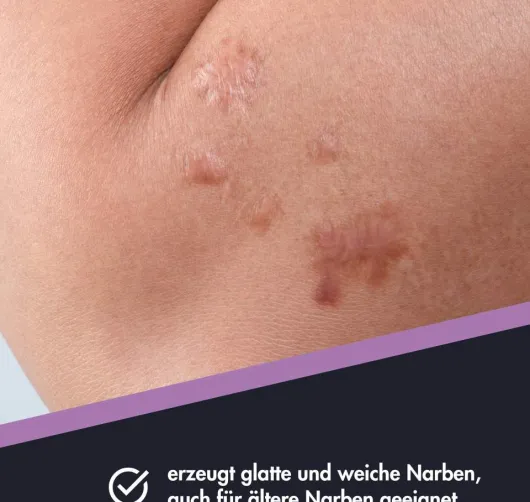 Narbenpflege Salbe Ensbona, 20 ml