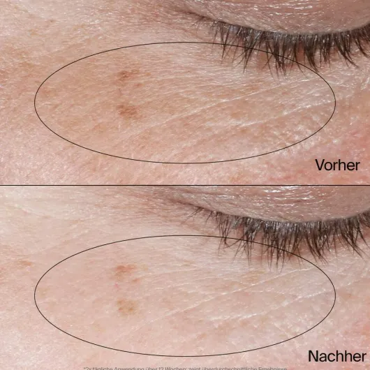 Neutrogena Collagen Bank Belebende Augen-Gel-Creme 15 G
