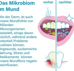 Nupure Probadent Probiotikum Mundflora Lemon 90 Lutschtabletten