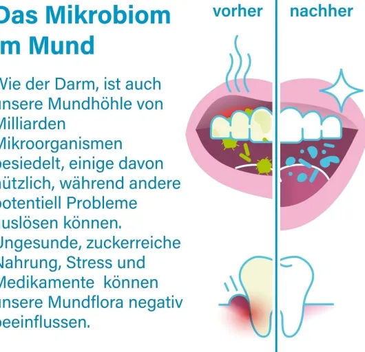 Nupure Probadent Probiotikum Mundflora Lemon 90 Lutschtabletten