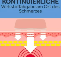 Nurofen 24-Stunden Schmerzpflaster 200 mg 4 Stück