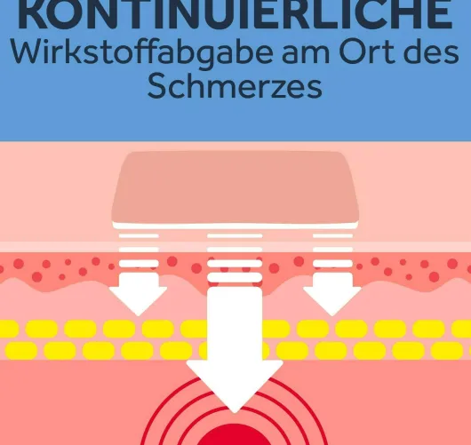 Nurofen 24-Stunden Schmerzpflaster 200 mg 4 Stück