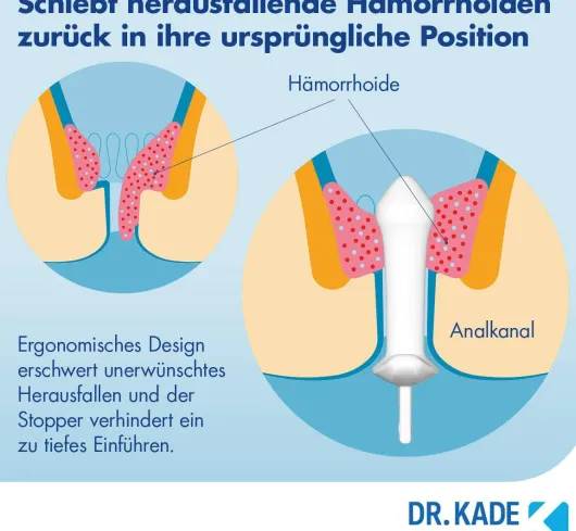 Postericare Hämorrhoiden-Stick 1 Stück