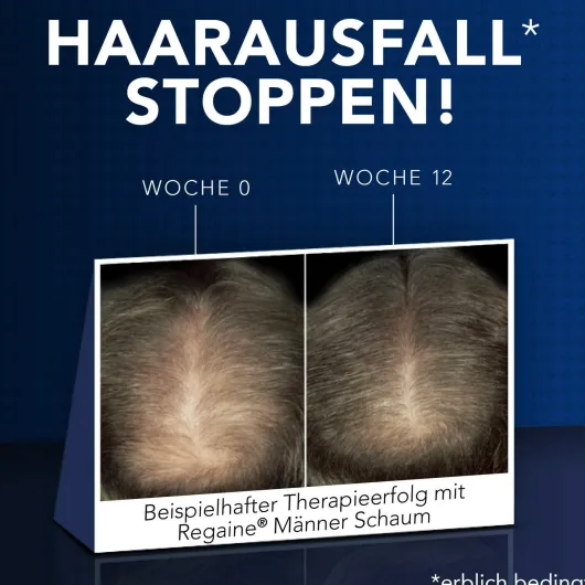 Regaine Männer 3 x 60 ml Lösung