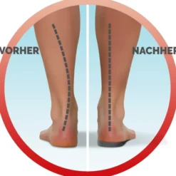 Scholl In-Balance Dreiviertel Einlagen 1 Paar Größe 37 - 39,5