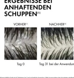 Vichy Dercos Anti-Schuppen Shampoo für trockene Kopfhaut 200 ml