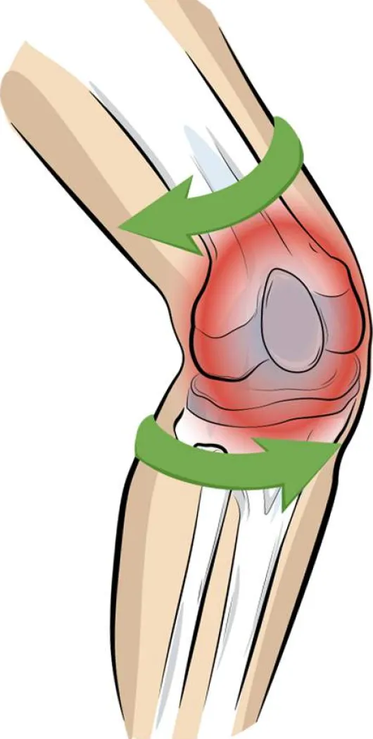 Vital Komfort Kniebandage PatellaTec Gr. XXL