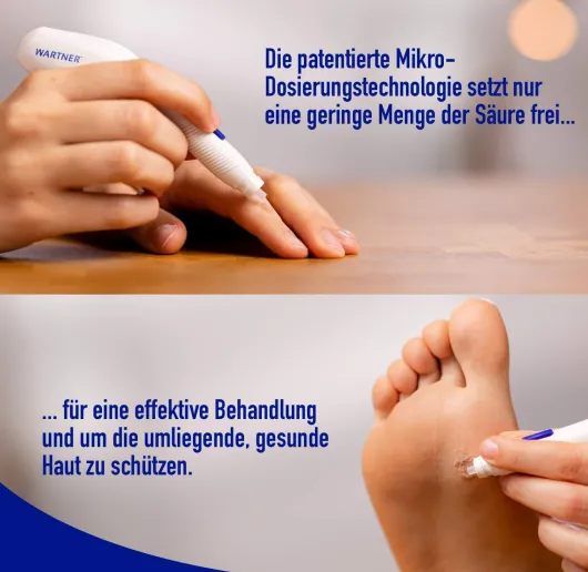 Wartner Stift gegen Warzen 2.0