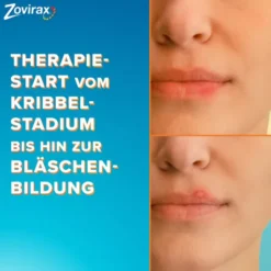 Zovirax Lippenherpescreme 2 g