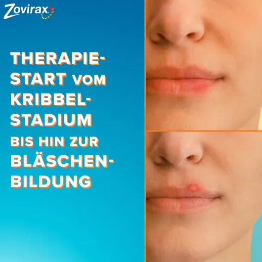 Zovirax Lippenherpescreme 2 g
